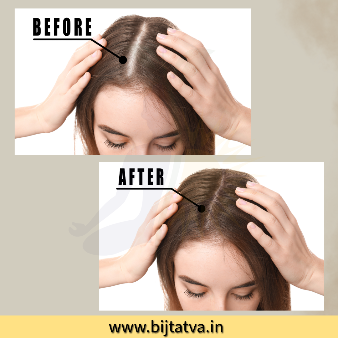 Before and After Results of Mango Seed Herbal Hair Mask – Visible Hair Fall Reduction and Healthier, Shinier Hair with BIJ Tatva

