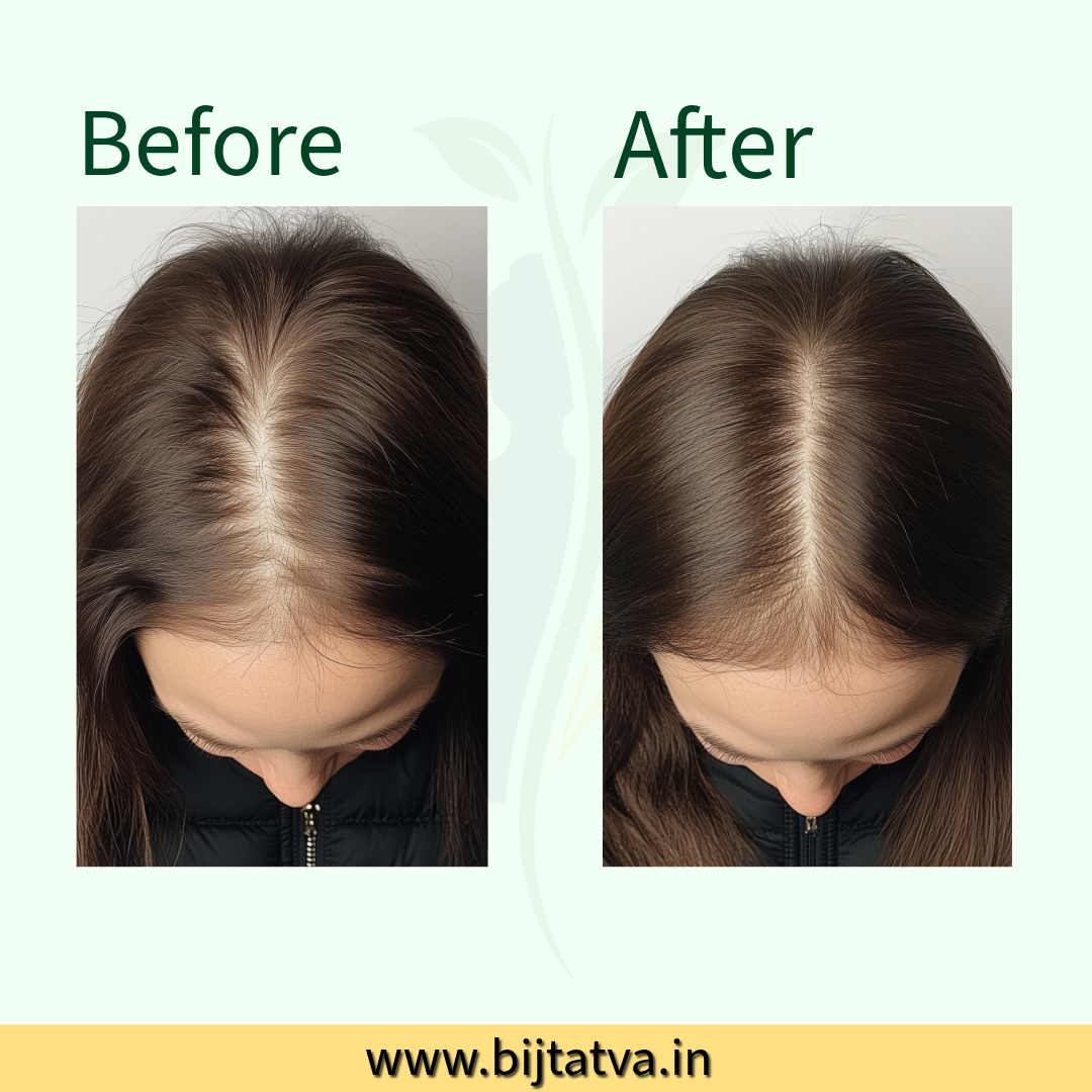 Before and After Results of BIJ Tatva Hair Regrowth Mask – Visible Reduction in Hair Fall & Thicker Hair